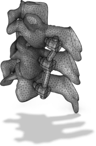 STL 导入系列教程